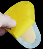 pedag t-form metatarsal arch supports peeled away